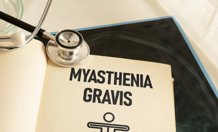 MYASTHENIA GRAVIS