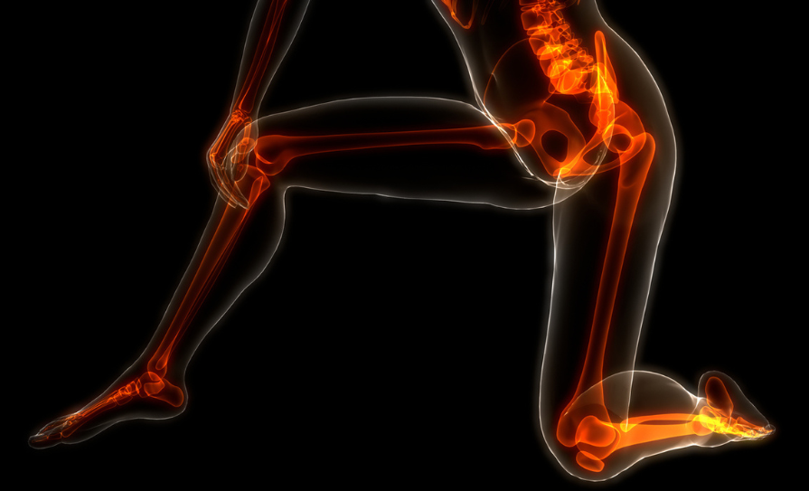 LATEST UPDATES IN OSTEOPOROSIS MANAGEMENT