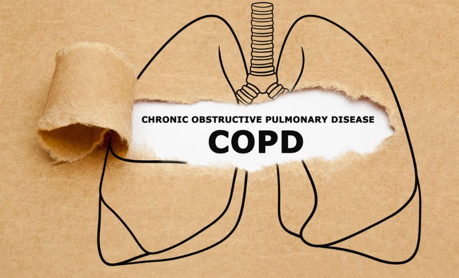 COPD